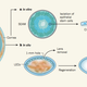 Image for article titled Remarkable surgery uses stem cells to regenerate an eye’s lens and restore vision